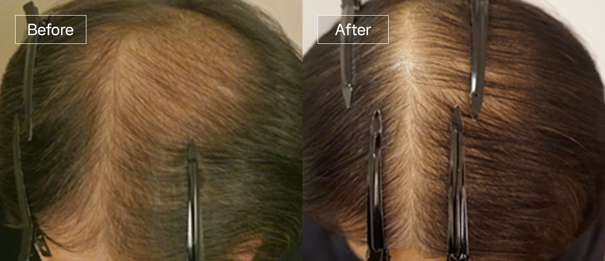 /filedata/md_board/20260102173050_wqcG0Isr_sub4_slide5.jpg 전후사진