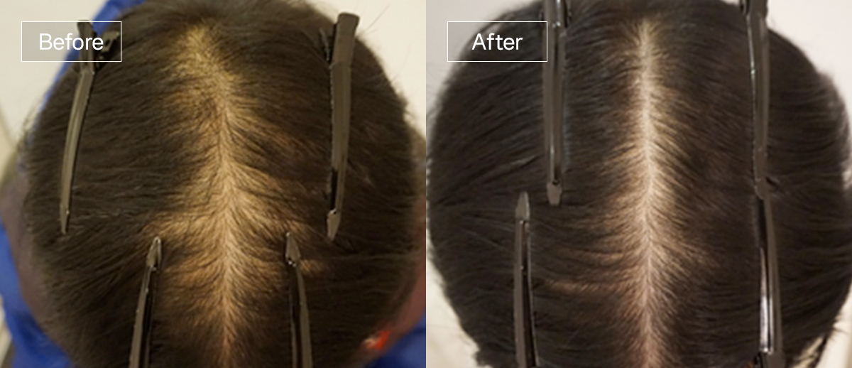 /filedata/md_board/20260102173105_CUWFuXtJ_sub4_slide4.jpg 전후사진