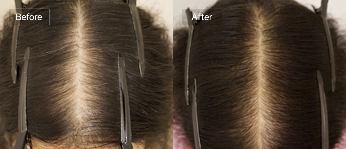 /filedata/md_board/20260102173112_gIK31b7p_sub4_slide3.jpg 전후사진