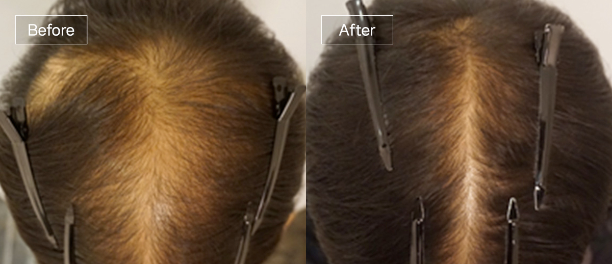 /filedata/md_board/20260102173121_NeGDzsdB_sub4_slide2.jpg 전후사진