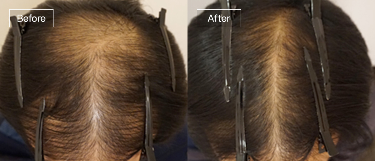 /filedata/md_board/20260102173128_4lHKnucF_sub4_slide1.jpg 전후사진