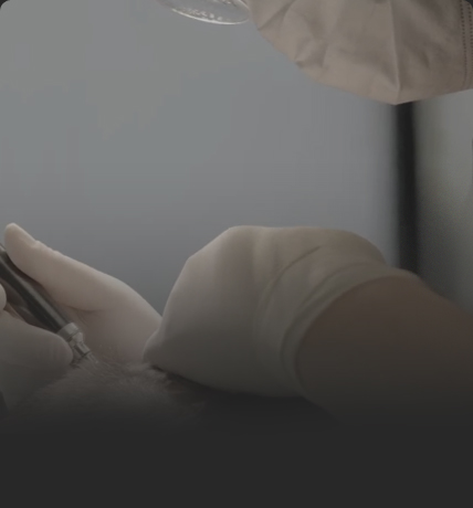 연세모벨르의원 SMP 두피문신